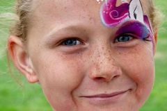Freckles